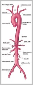 aorta branches - Graph Diagram