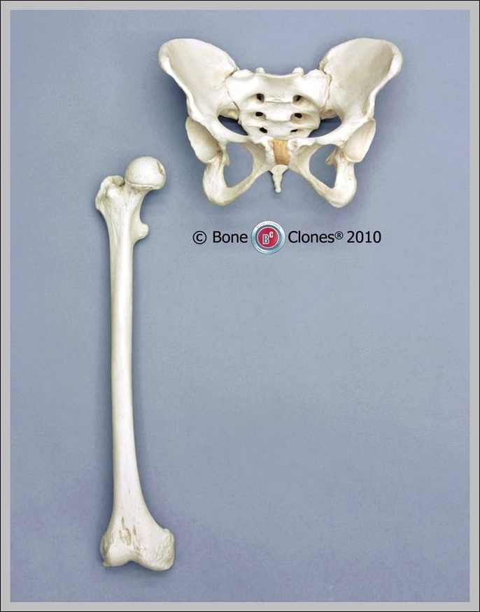 human femur bone picture