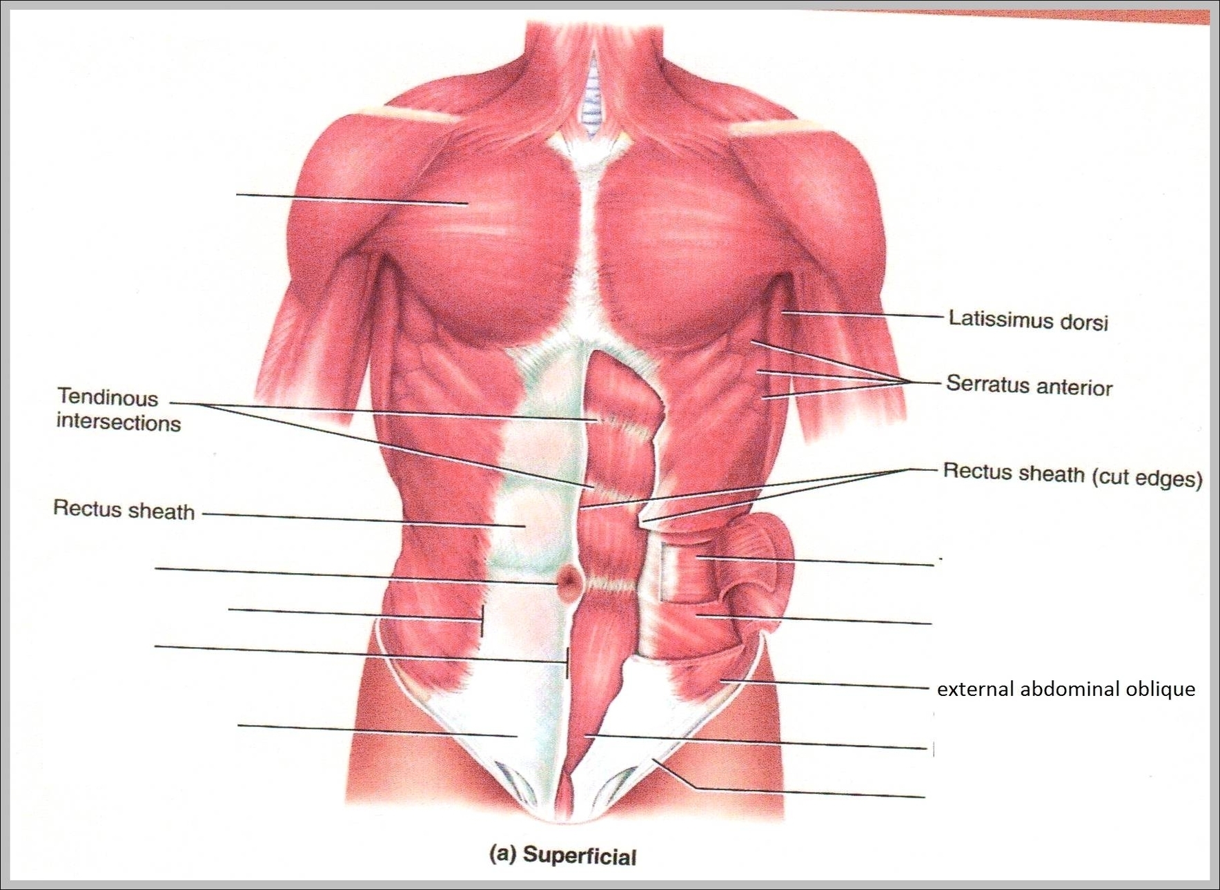 internal abdominal oblique