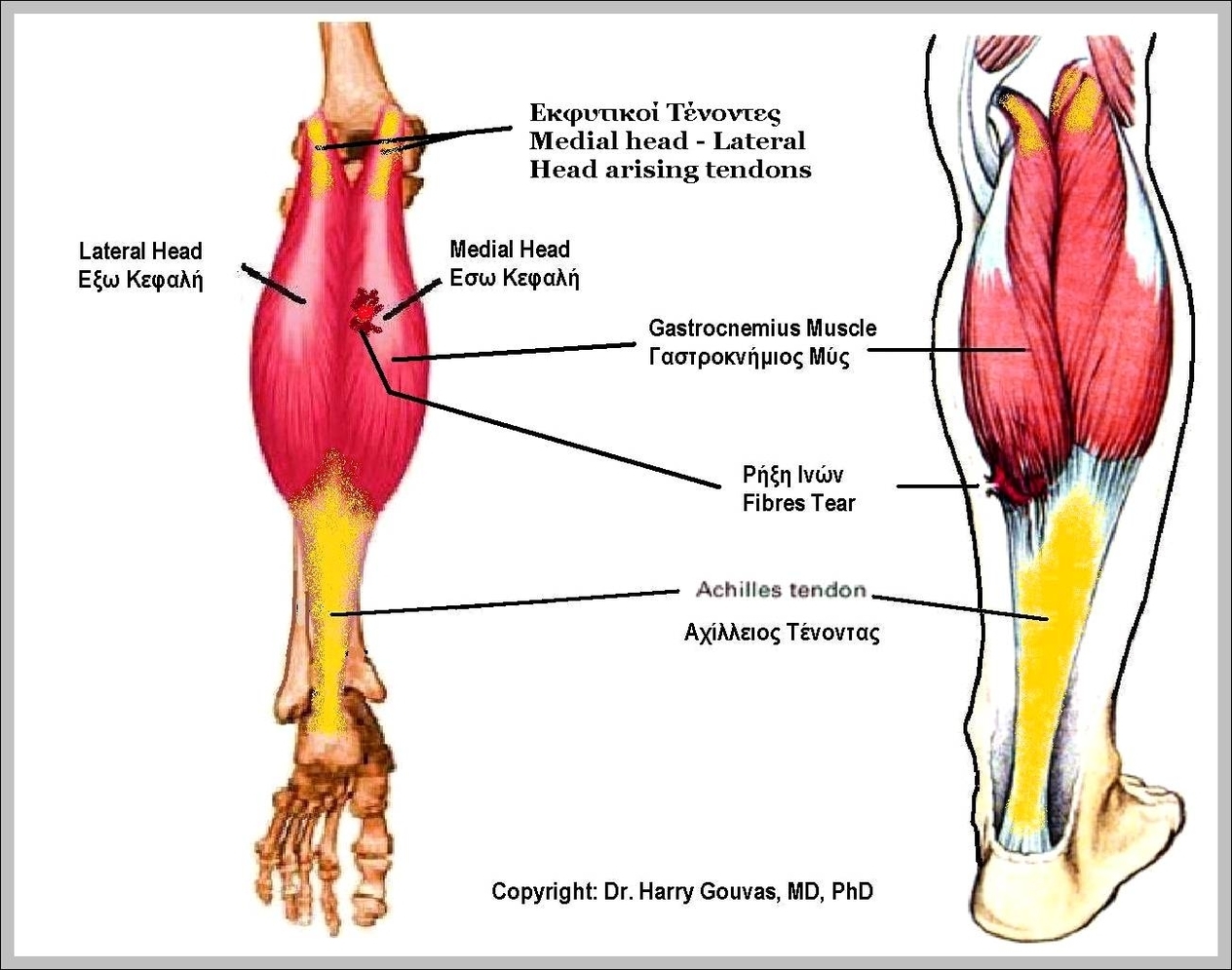 lateral gastrocnemius