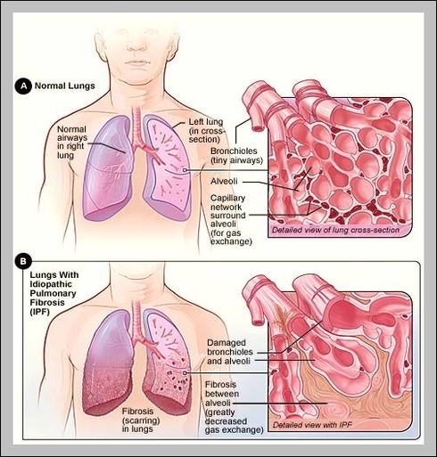 location of lungs
