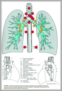 Lymph Node Chart