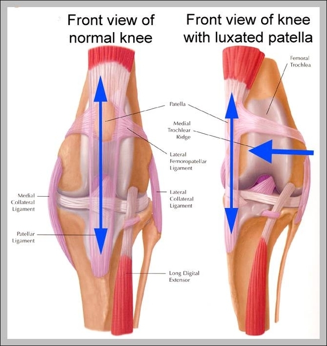 picture of a knee cap