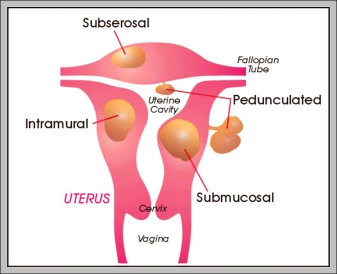 the uterus