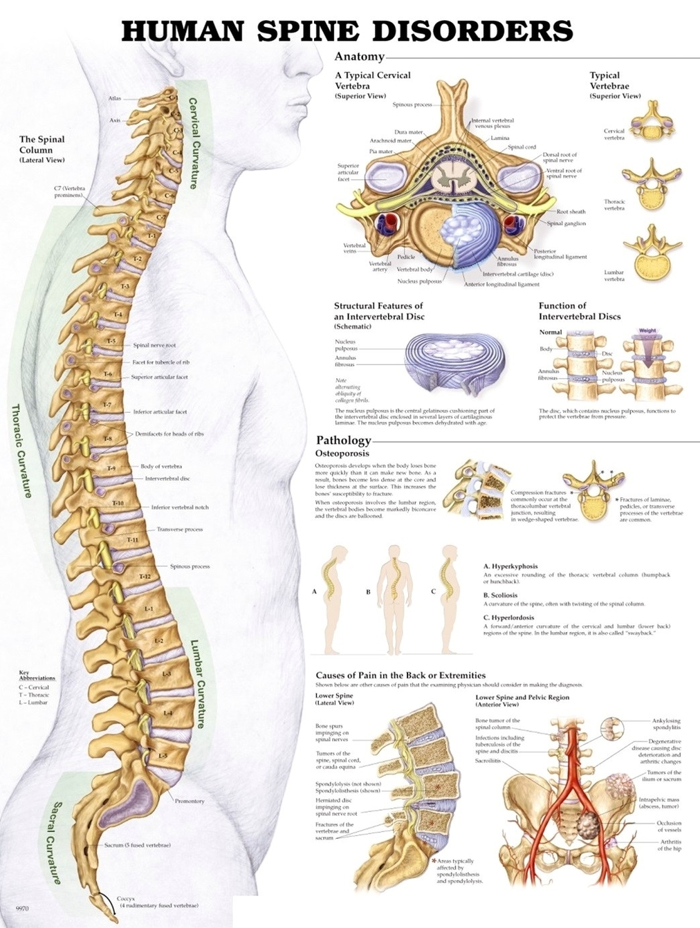 Spine disorders diagram