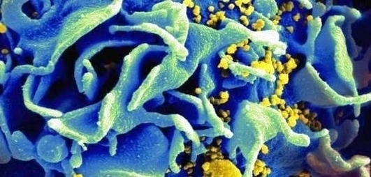 Aids Cure Would Make Hiv Virus Self Destruct Image Image