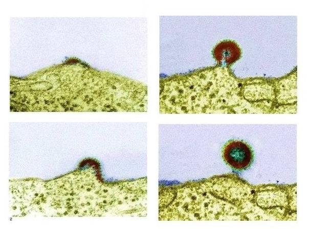 Aids Virus Stages Image
