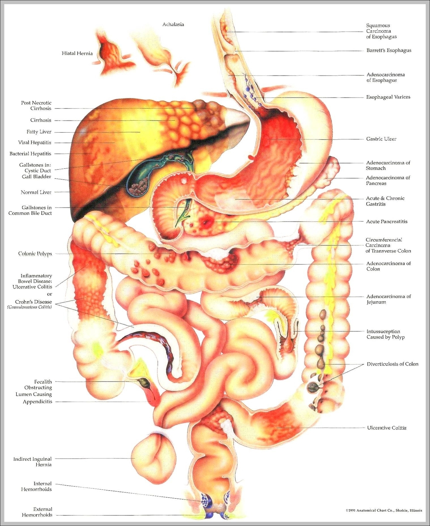 Anatomy Of Abdomen1 Image