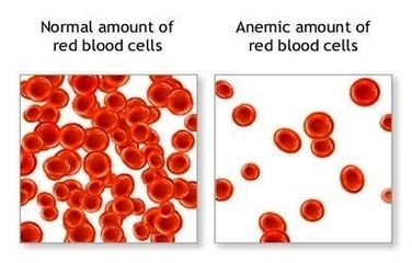 Anemia Red Blood Cells Image