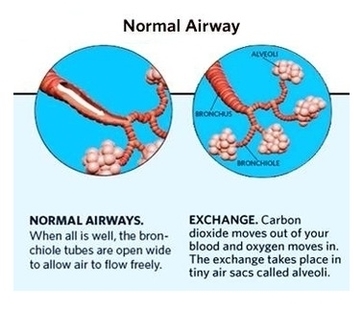 Asthma Attack Anatomy Image
