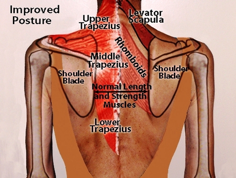 Back Posture Diagram Image