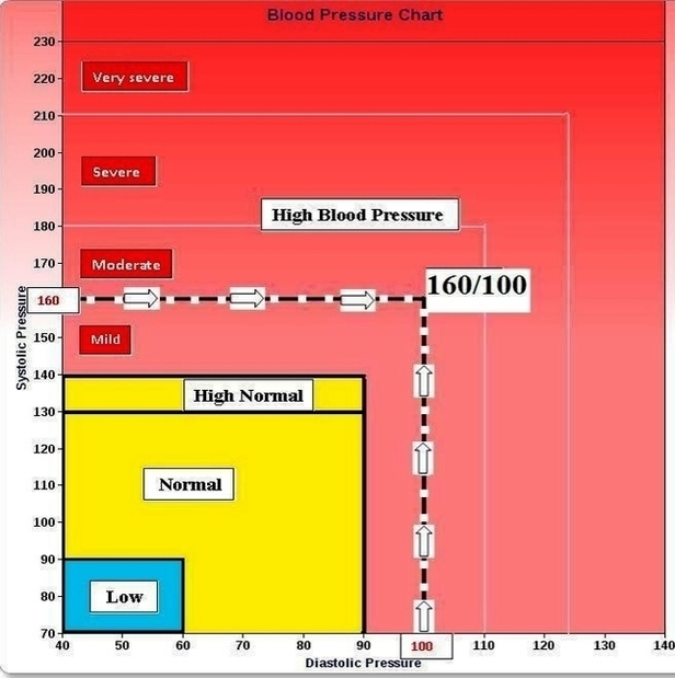 Blood Pressure Chart Example Image