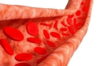 Can High Blood Pressure Cause Blood In Urine Image