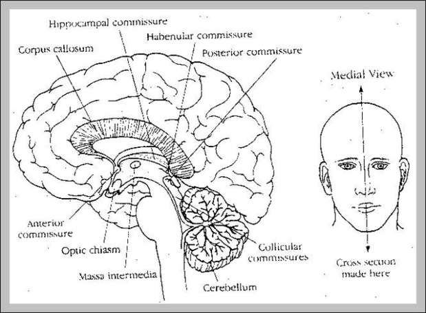 Cerebral Peduncle Image