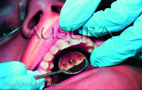 Dental Restoration Id Figure Image