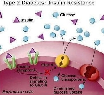 Diabetes Mellitus Type Image