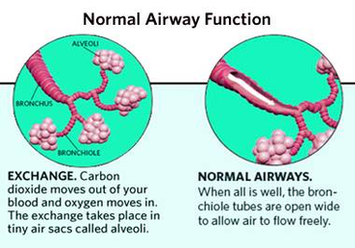 Diagram Asthma Attack Anatomy Image