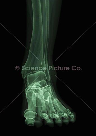 Diagram Of Bones Of The Foot Spc Id Image