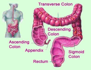 Diagram Of Colon Cancer Prevention Image - Graph Diagram