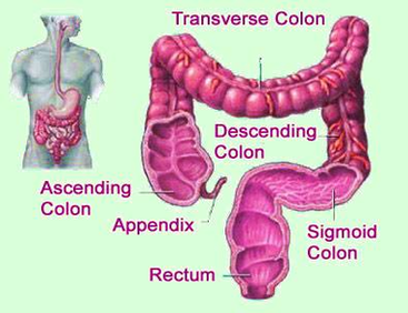 Diagram Of Colon Cancer Prevention Image