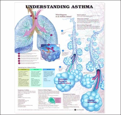 Diagram Pt Understanding Asthma Image