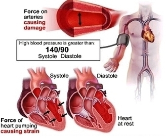 Diastolic Blood Pressure Image