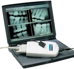 Digital Dental Xray Image