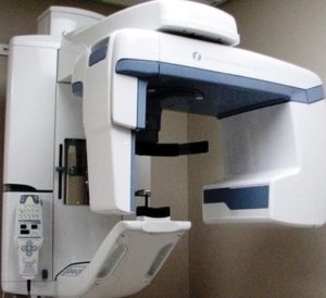 Digital Xray Image - Graph Diagram