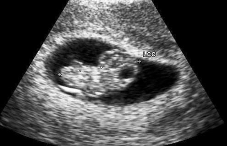 Embryo At Weeks Image