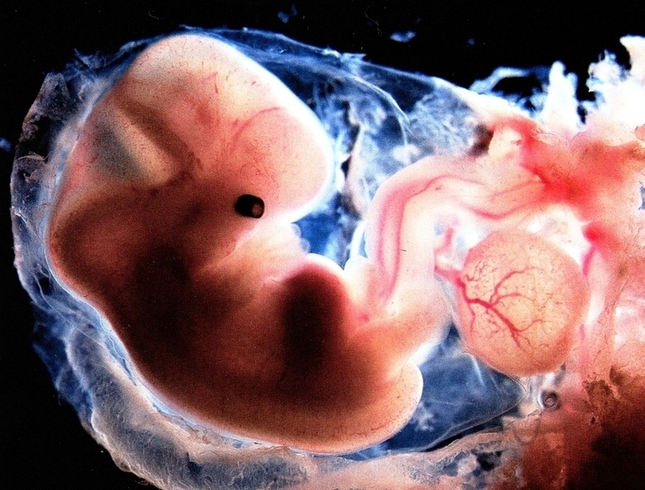 Embryo Weeks Old Image
