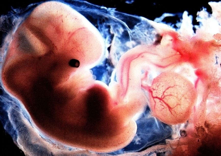 Embryo Weeks Old1 Image