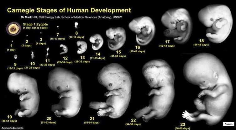 Fetal Growth Image