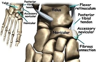 Foot Accessory Navicular Anat1 Image