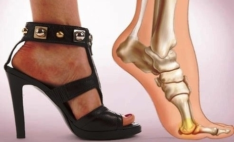 Foot Pain From Heels Image