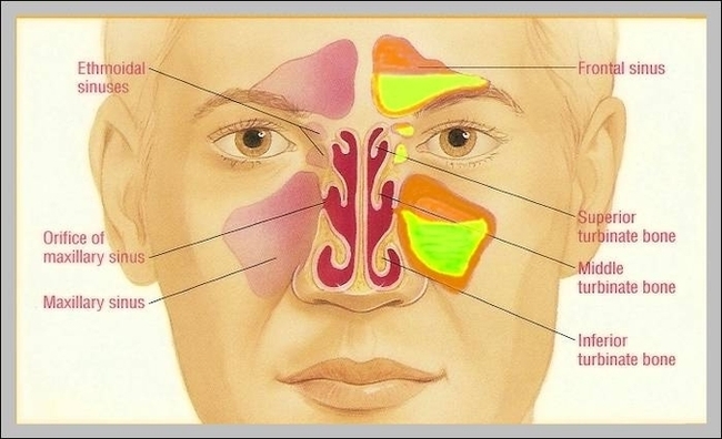 Frontal Sinus Image