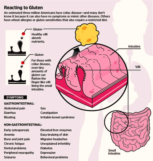 Gluten Free Diagram Image