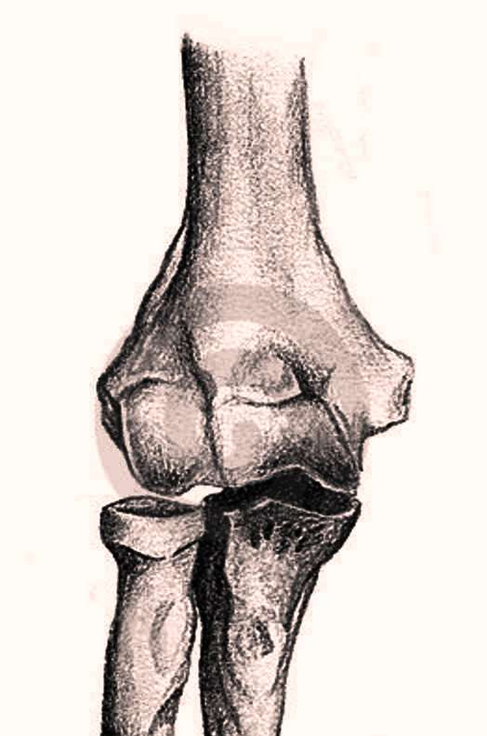 Human Anatomy Bones Arm Image