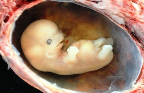 Human Embryo Approximately Weeks Estimated Gestational Age Image