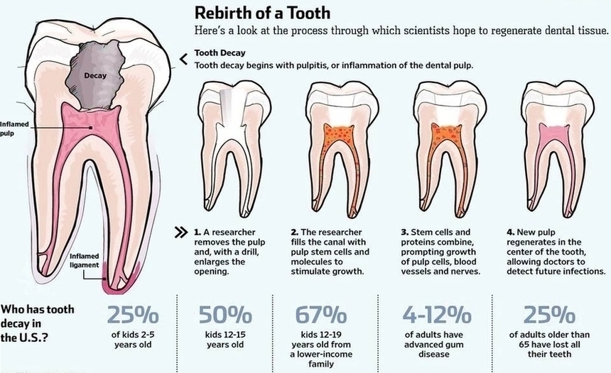 Human Teeth Image