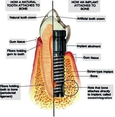 Implantalogy Image