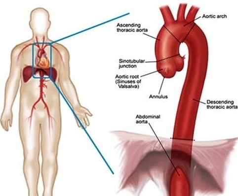 Lg Heart Aortic Anatomy Image