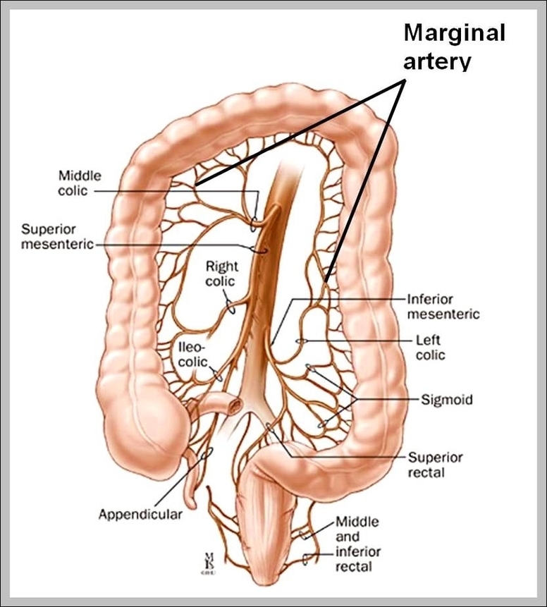 Mesenteric Artery Image