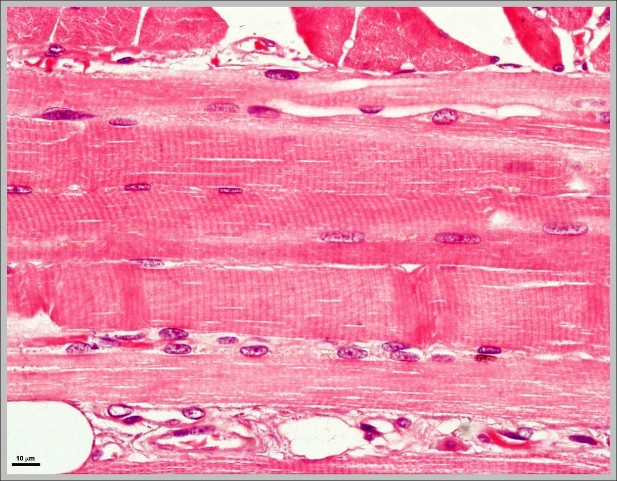 Picture Of Skeletal Muscle Image