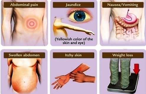 Signs And Symptoms Image