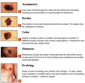 Skin Cancer Warning Signs Image - Graph Diagram