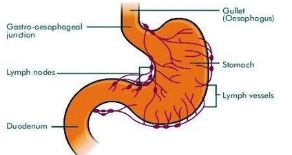 Stomach Lymphnodes Image