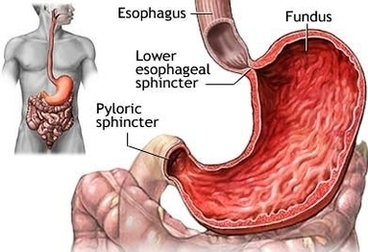 Stomach Ulcer Symptoms Image