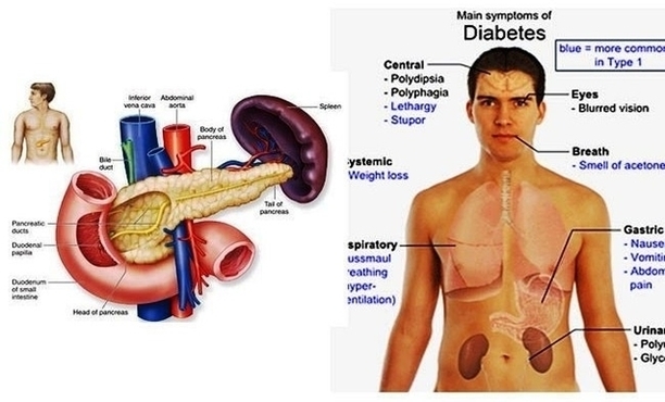 Symptoms Or Signs Of Diabetes Common Image