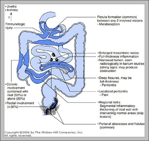 Terminal Ileum Anatomy Image