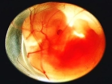 Week Human Fetus In Utero Image